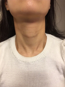 %EA%B0%95%EC%A0%95%ED%98%9C%20(13)(0).jpg