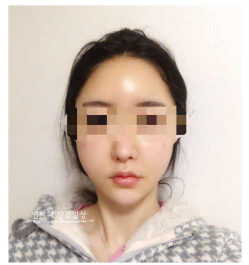 20200424_144902(0).png