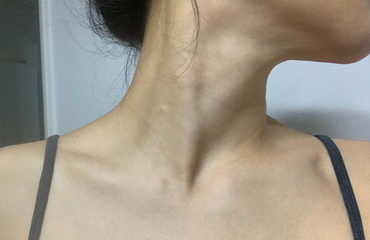 SE-2c626ab3-daa0-4a49-81c1-c5b201173b71.jpg SE-2c626ab3-daa0-4a49-81c1-c5b201173b71.jpg