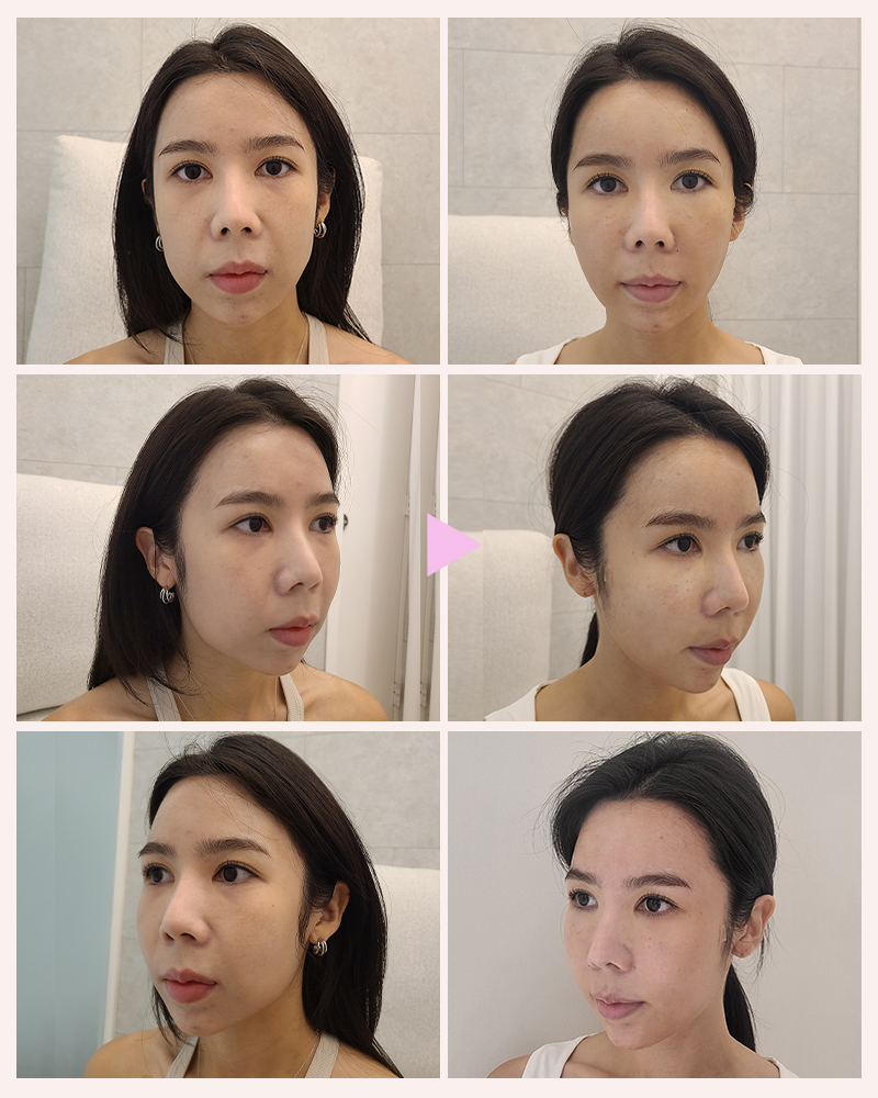 2848580917329053d5909b922f52b83d_1756173088_088.jpg 2848580917329053d5909b922f52b83d_1756173088_088.jpg