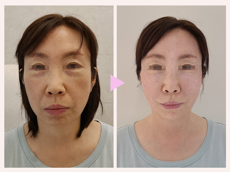 2848580917329053d5909b922f52b83d_1756175195_2924.jpg 2848580917329053d5909b922f52b83d_1756175195_2924.jpg