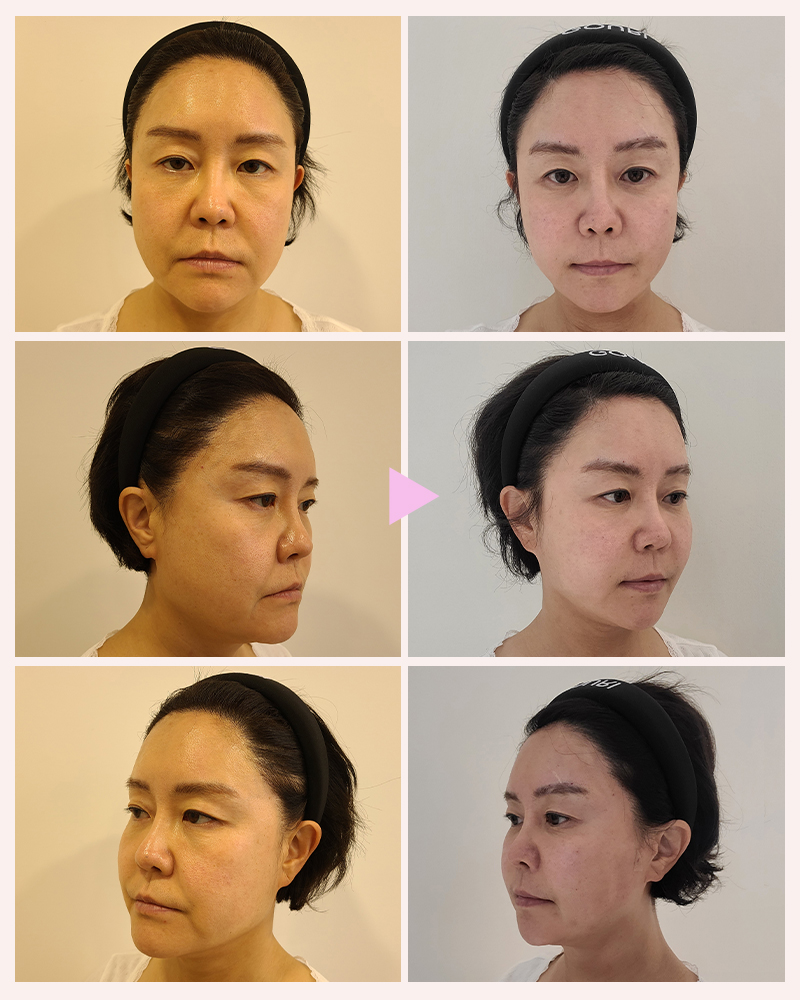 2848580917329053d5909b922f52b83d_1756175206_2959.jpg 2848580917329053d5909b922f52b83d_1756175206_2959.jpg