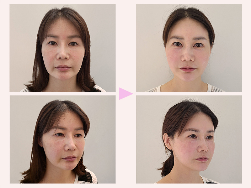 bece4f43e371b7fd4d5a147841f9eee9_1761269979_3859.jpg bece4f43e371b7fd4d5a147841f9eee9_1761269979_3859.jpg