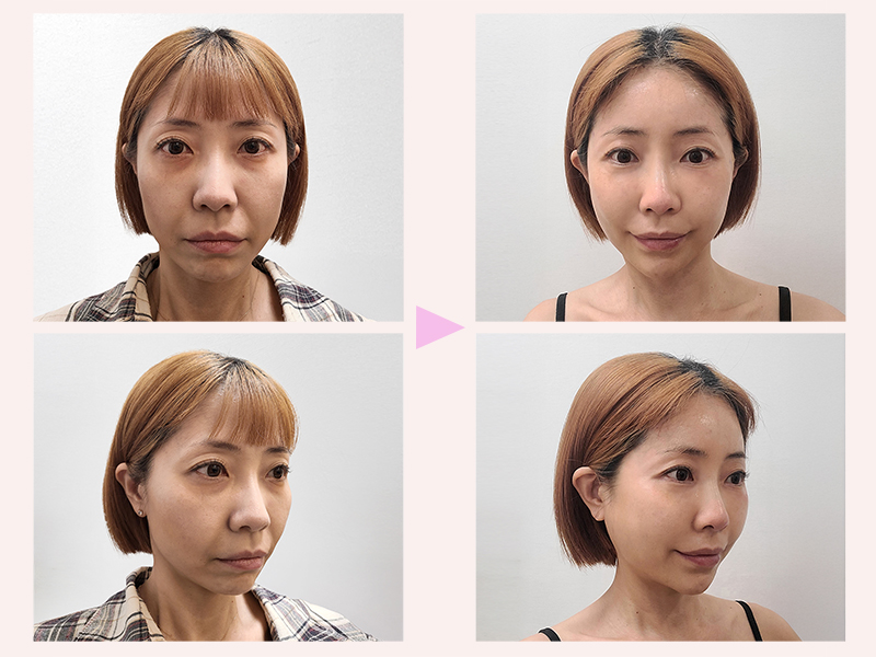 bece4f43e371b7fd4d5a147841f9eee9_1761270516_2303.jpg bece4f43e371b7fd4d5a147841f9eee9_1761270516_2303.jpg