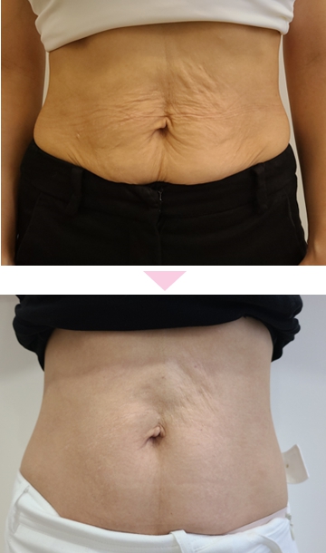 bece4f43e371b7fd4d5a147841f9eee9_1761275725_9168.jpg bece4f43e371b7fd4d5a147841f9eee9_1761275725_9168.jpg