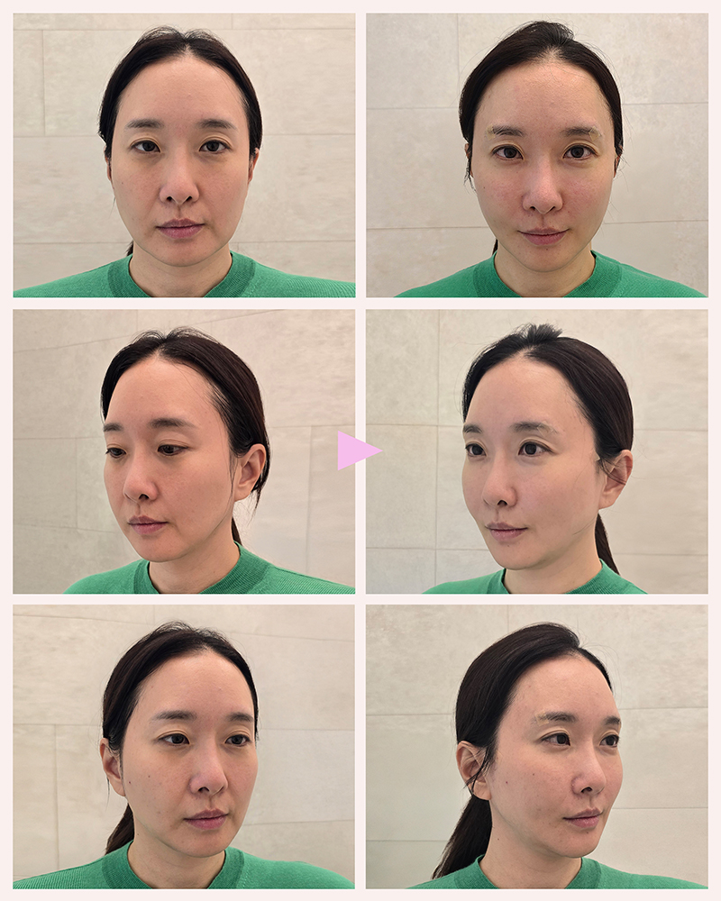 935f7a245ebff824c4f5cef4b910d3b6_1763693049_7896.jpg 935f7a245ebff824c4f5cef4b910d3b6_1763693049_7896.jpg