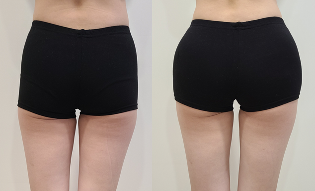 935f7a245ebff824c4f5cef4b910d3b6_1763694486_3383.png 935f7a245ebff824c4f5cef4b910d3b6_1763694486_3383.png