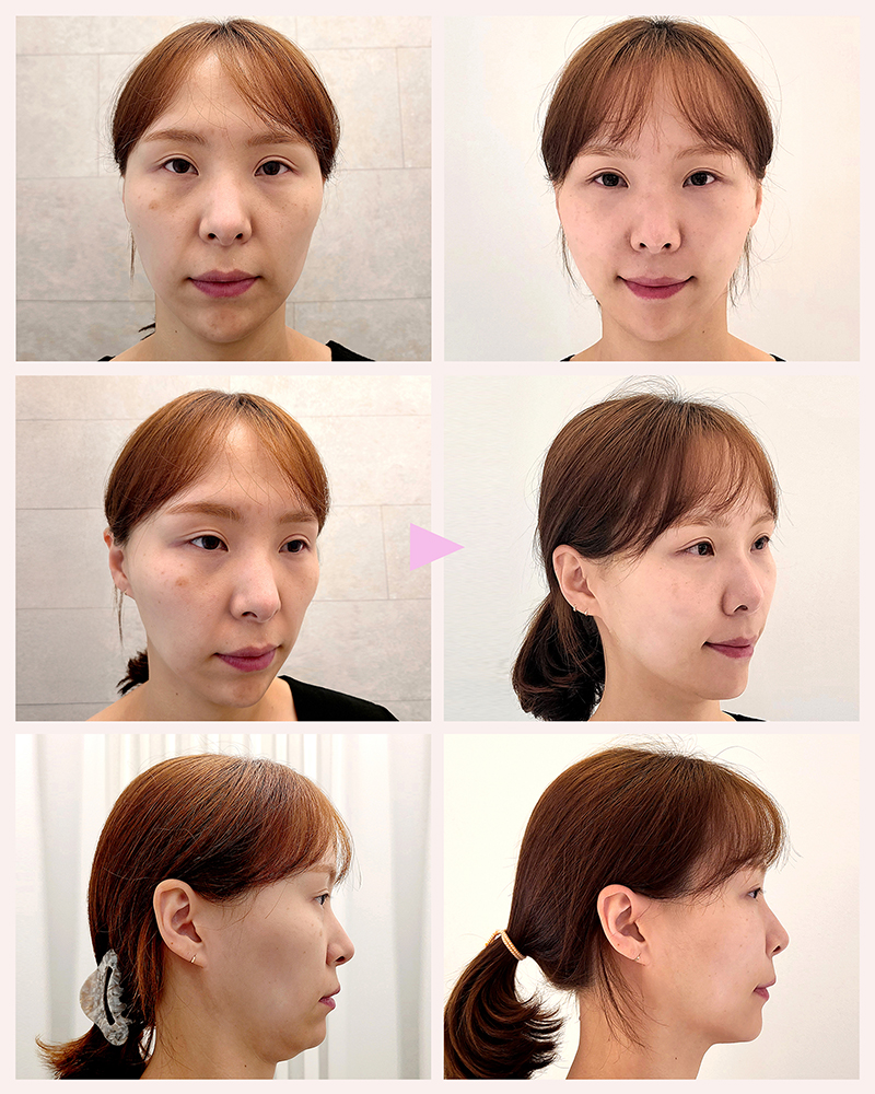 935f7a245ebff824c4f5cef4b910d3b6_1763696710_0888.jpg 935f7a245ebff824c4f5cef4b910d3b6_1763696710_0888.jpg